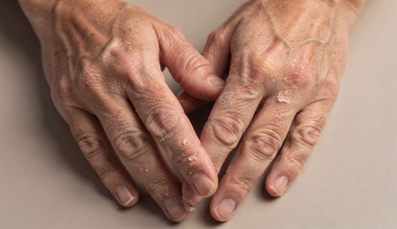 Mani secche, ruvide, segnate… Quale crema scegliere in base alle tue esigenze?